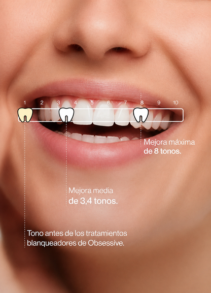 PURPLE V34 - Blanqueador Dental